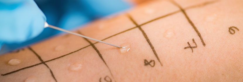 化學品皮膚致敏試驗